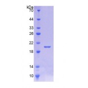 SDS-PAGE analysis of Human CALML5 Protein.