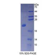 SDS-PAGE analysis of Human CALML3 Protein.