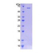 SDS-PAGE analysis of Rat NAT2 Protein.