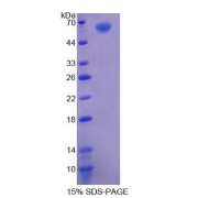 SDS-PAGE analysis of Human AGK Protein.