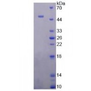 SDS-PAGE analysis of Rabbit ATP1a1 Protein.