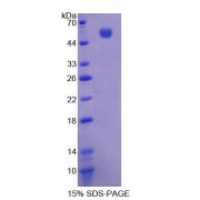 SDS-PAGE analysis of Mouse LPCAT1 Protein.