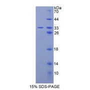 SDS-PAGE analysis of Human ARSA Protein.