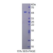 SDS-PAGE analysis of Human TTF1 Protein.