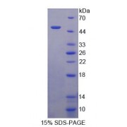 SDS-PAGE analysis of Rat TCN2 Protein.