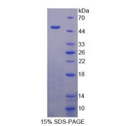 SDS-PAGE analysis of Rat TCN2 Protein.