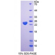 SDS-PAGE analysis of Rat SAT1 Protein.