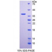 SDS-PAGE analysis of Human GNMT Protein.