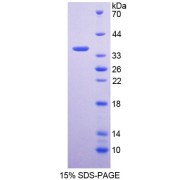 SDS-PAGE analysis of Human GNMT Protein.