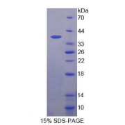 SDS-PAGE analysis of Human ANKRD1 Protein.