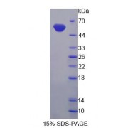 SDS-PAGE analysis of Rat UGT2B7 Protein.