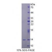 SDS-PAGE analysis of Human UBQLN2 Protein.