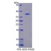 SDS-PAGE analysis of Human SPTLC3 Protein.