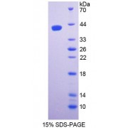 SDS-PAGE analysis of Mouse SPTLC1 Protein.