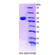 SDS-PAGE analysis of Mouse SPR Protein.