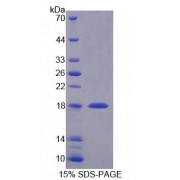 SDS-PAGE analysis of Human SNAPAP Protein.
