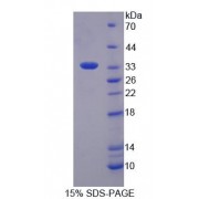SDS-PAGE analysis of Human SMUG1 Protein.