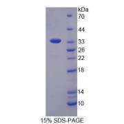 SDS-PAGE analysis of Human SMUG1 Protein.