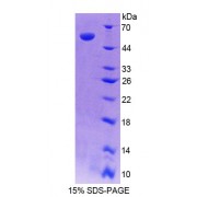 SDS-PAGE analysis of recombinant Human RARRES1 Protein.