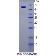 SDS-PAGE analysis of Mouse PGP Protein.