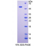 SDS-PAGE analysis of Human OXCT1 Protein.