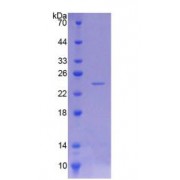 SDS-PAGE analysis of Rat PNPLA6 Protein.