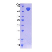 SDS-PAGE analysis of Human NADK Protein.