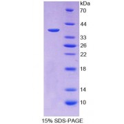 SDS-PAGE analysis of Human IDUa Protein.