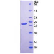 SDS-PAGE analysis of Human HAVCR2 Protein.