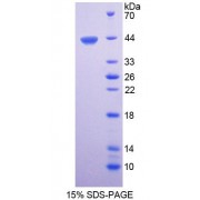 SDS-PAGE analysis of Human CTBS Protein.