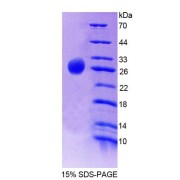 SDS-PAGE analysis of Human CSN1 Protein.