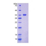 SDS-PAGE analysis of Human CHIT1 Protein.