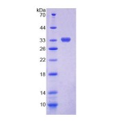 SDS-PAGE analysis of Human CHIT1 Protein.