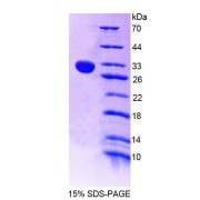 SDS-PAGE analysis of Mouse CHIT1 Protein.