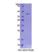 SDS-PAGE analysis of Rat BLVRA Protein.