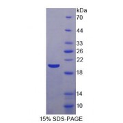 SDS-PAGE analysis of Human aMACR Protein.