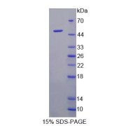 SDS-PAGE analysis of Human AHRR Protein.