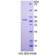 SDS-PAGE analysis of Human MUTYH Protein.