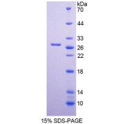 SDS-PAGE analysis of Human MUTYH Protein.