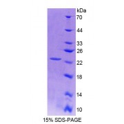 SDS-PAGE analysis of recombinant Rat vHL Protein.