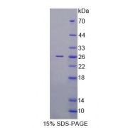 SDS-PAGE analysis of Human RAB1A Protein.