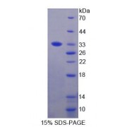 SDS-PAGE analysis of Human PIK3Cd Protein.