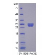 SDS-PAGE analysis of Rat ARHGEF7 Protein.