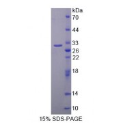 SDS-PAGE analysis of Human ISL1 Protein.
