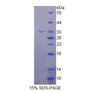 SDS-PAGE analysis of Human SNAI1 Protein.