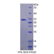 SDS-PAGE analysis of recombinant Human ADAM22 Protein.