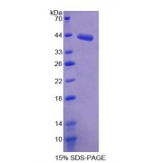 SDS-PAGE analysis of Mouse SDHC Protein.