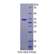 SDS-PAGE analysis of Mouse PRKDC Protein.