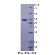 SDS-PAGE analysis of Mouse PRKDC Protein.