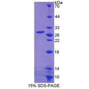 SDS-PAGE analysis of Human EMR1 Protein.